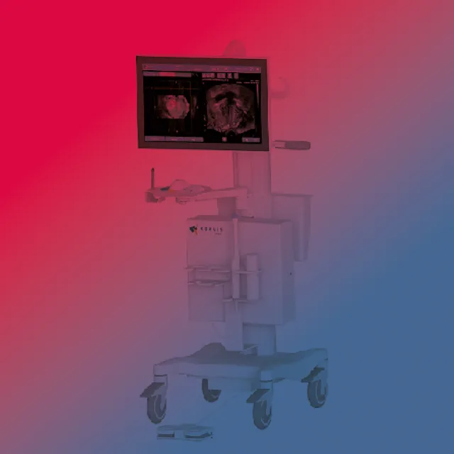 MRI Fusion Biopsy