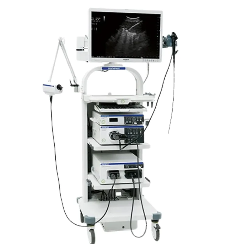 EBUS (Endobronşiyal Ultrasonografi)