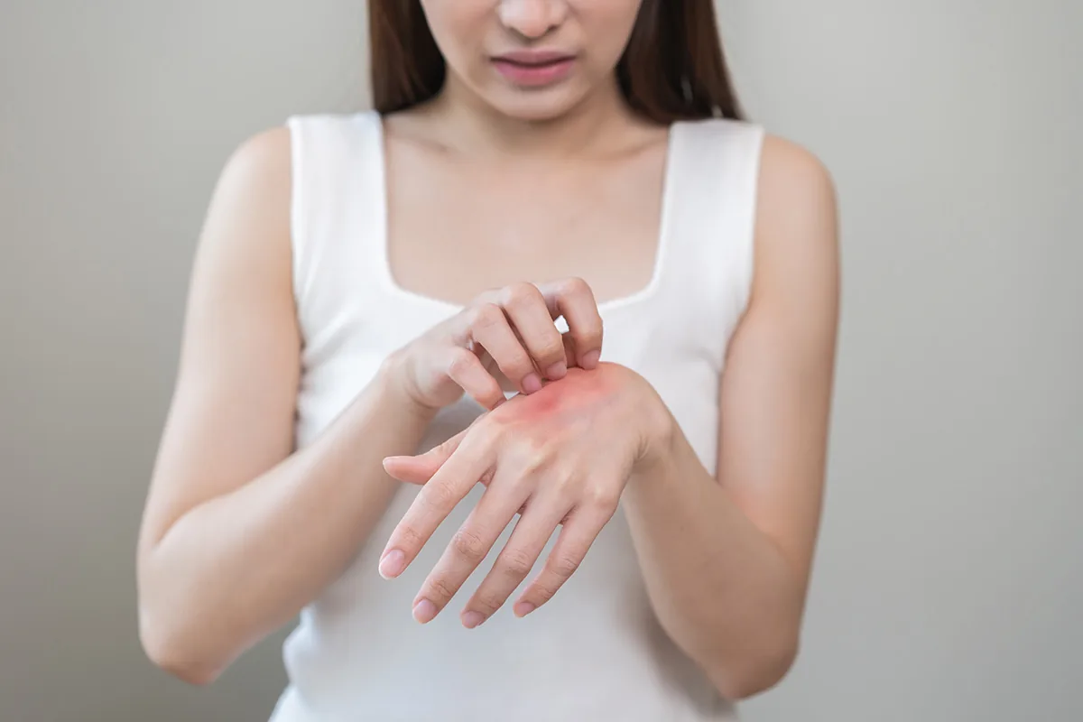 Uyuz Nedir? Uyuz Belirtileri, Bulaşma Yolları ve Etkili Tedavi Yöntemleri