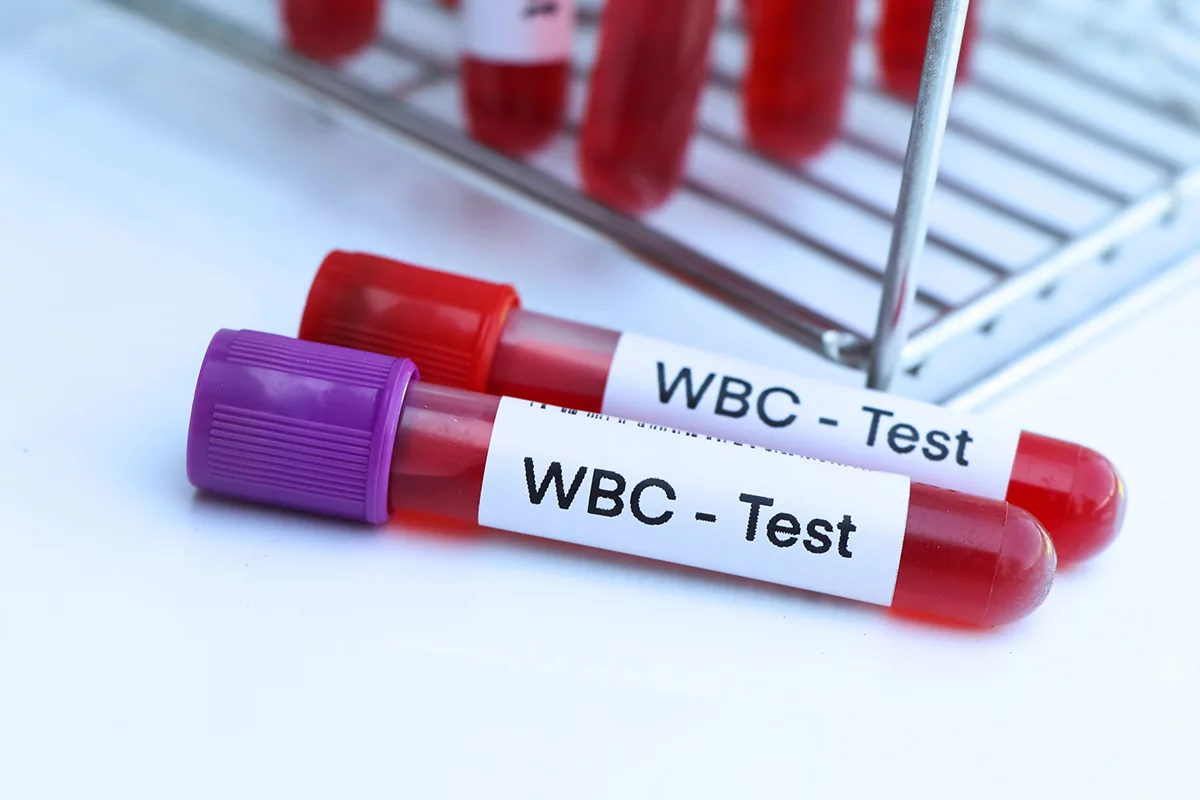 WBC Nedir? WBC Düşüklüğü ve WBC Yüksekliği Nedir?