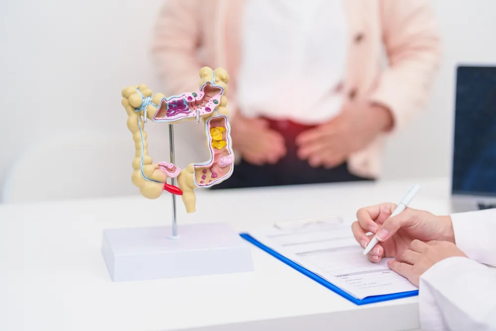 Ülseratif Kolit Nedir? Ülseratif Kolitin Belirtileri Nelerdir?