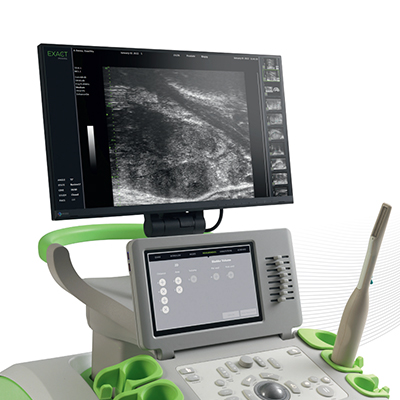 Mikro Ultrason Transperineal Biyopsi