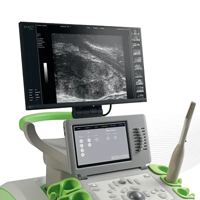 Mikro Ultrasonografi (Transperineal MRI Füzyon Prostat Biyopsisi)