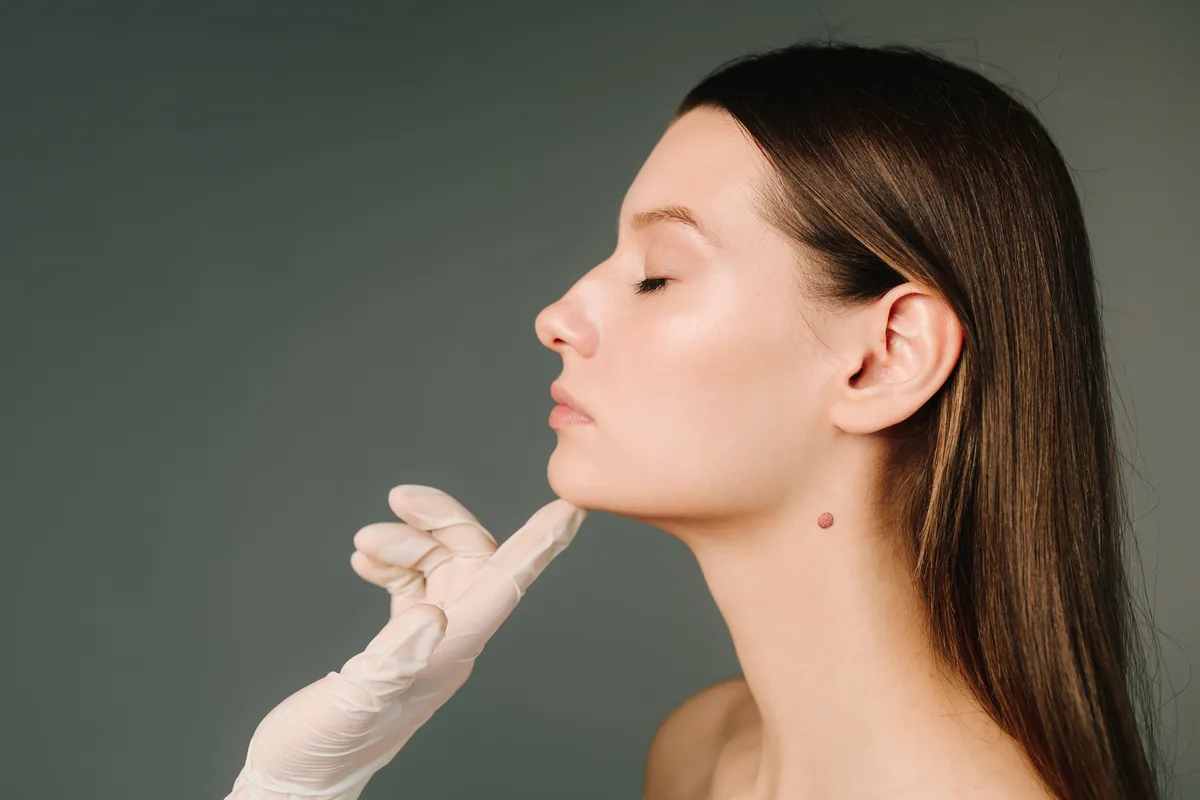 Chin Aesthetics (Genioplasty)