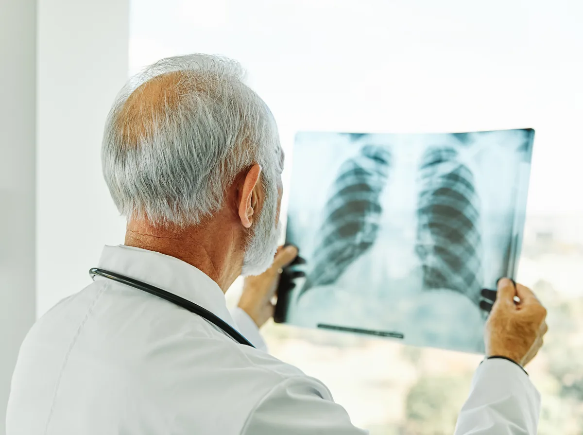 Surgical Treatment of Lung Cancer