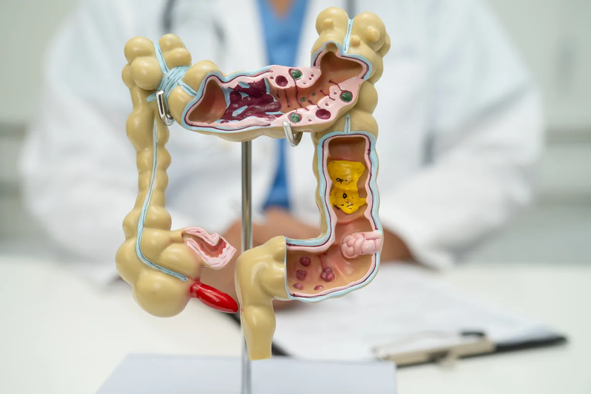 Types, Signs, Diagnosis and Treatment Methods of Colitis