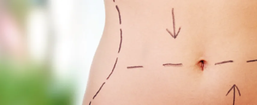 Liposuction için ideal hasta kimdir?