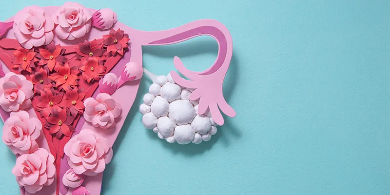 Polikistik Over Sendromu'nda (PCOS) Doğru Bilinen Yanlışlar ve Gerçekler