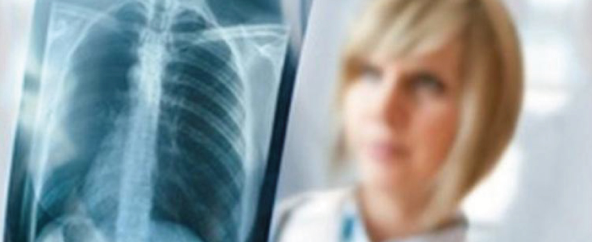 Akciğer Kanserinin Cerrahi Yöntemlerle Tedavisi