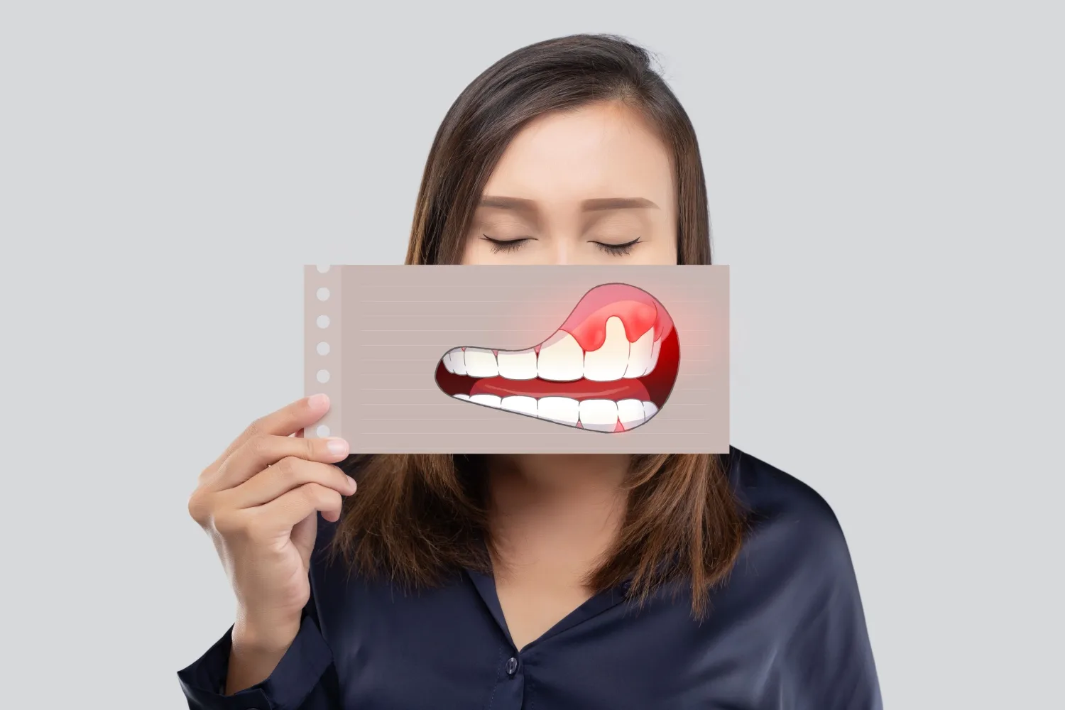 Periodontitis Nedir? Gingivit ve Periodontal Hastalıklar