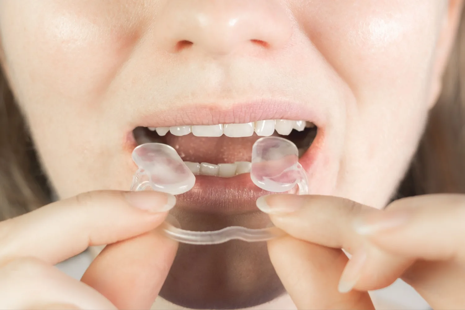 Bruksizm (Diş Sıkma) Nedir? Tedavi Yöntemleri Nelerdir?