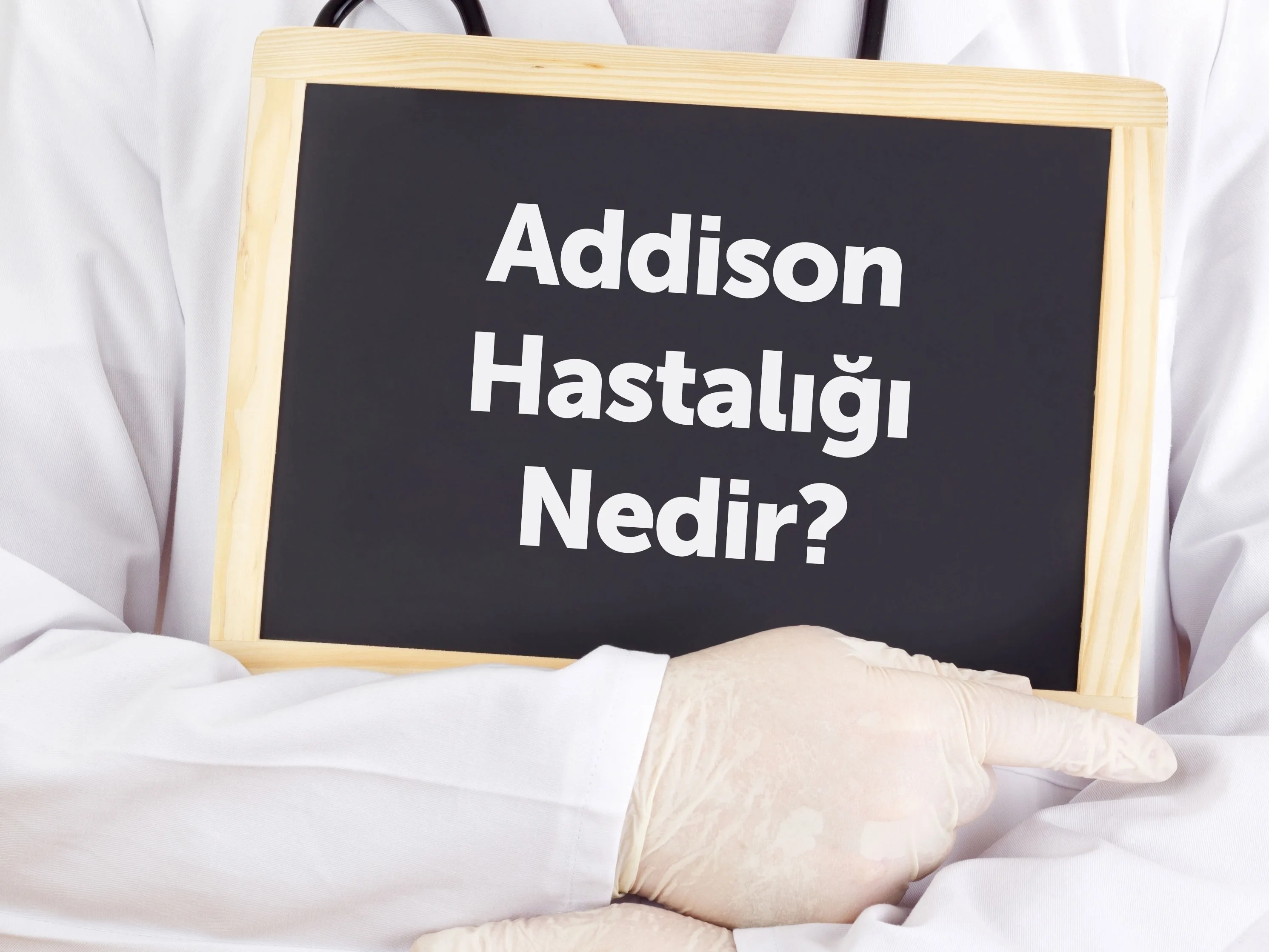 Addison Hastalığı Nedir? Addison Hastalığının Belirtileri Nelerdir?