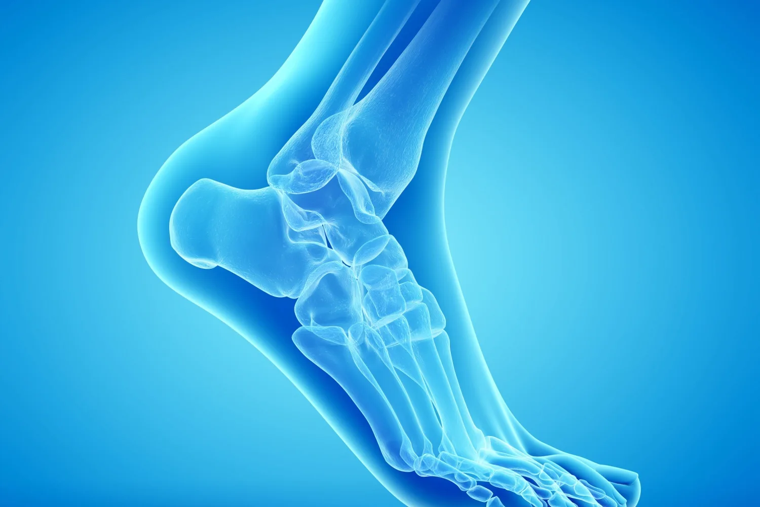 Peroneal Tendon Yırtığı Nedir ve Tedavi Yöntemleri Nelerdir?