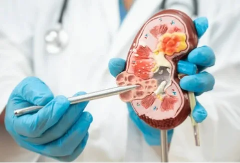 Böbrek Yetmezliğinin Nedeni: Diyabet ve Obezite