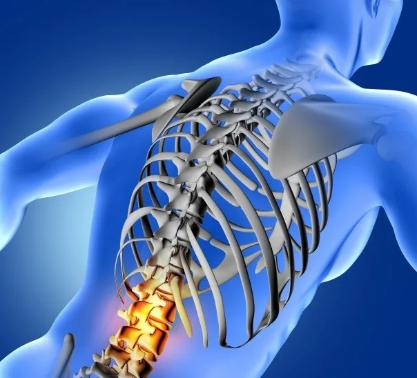 Bel Fıtığı Belirtileri Nelerdir?