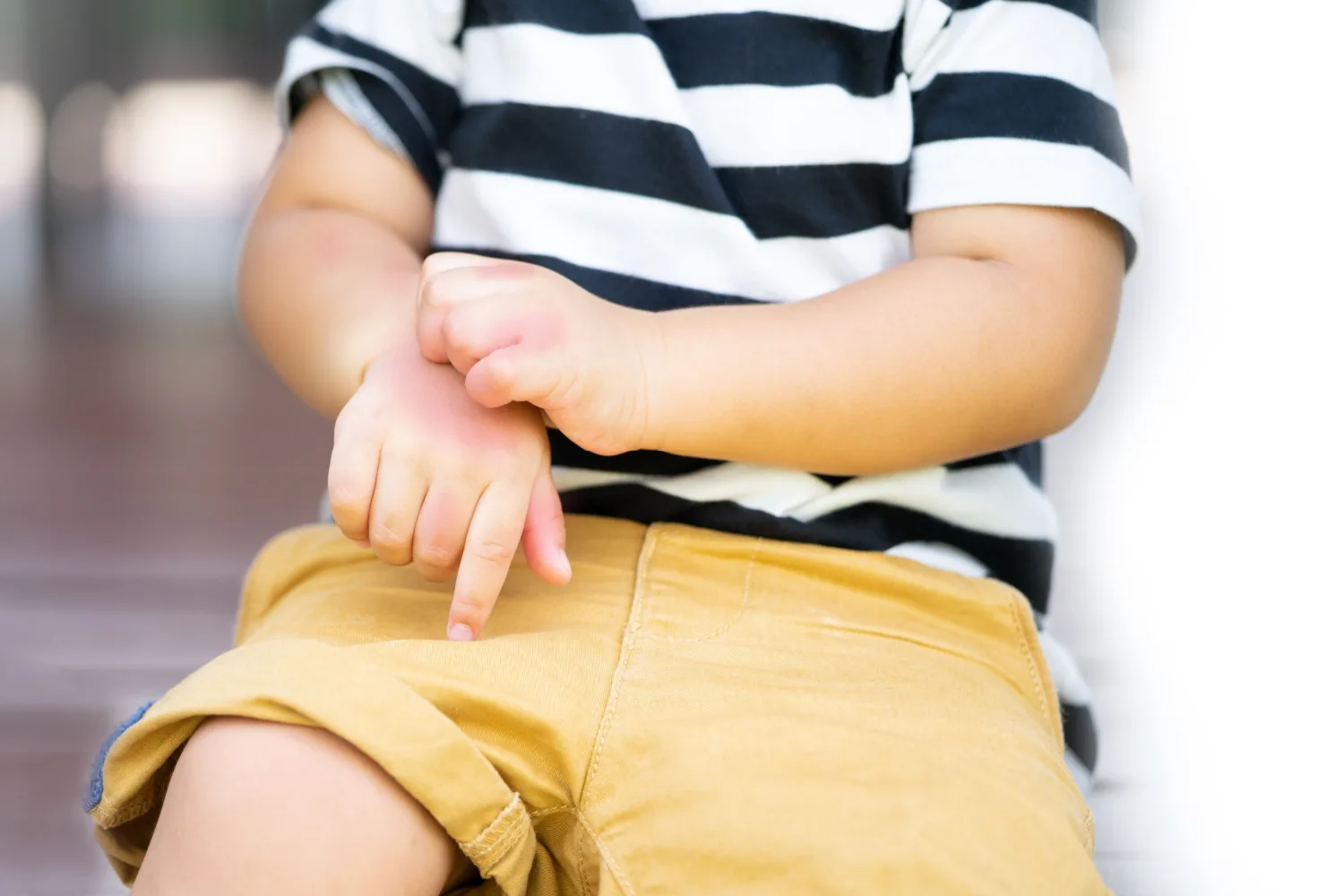 Çocuklarda Böcek Isırmaları ve Tedavi Yöntemleri