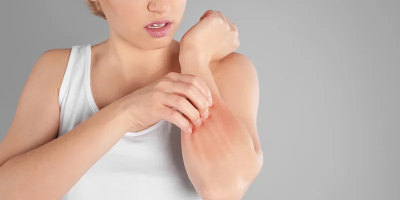 Zona Hastalığı Nedir, Belirtileri nelerdir?