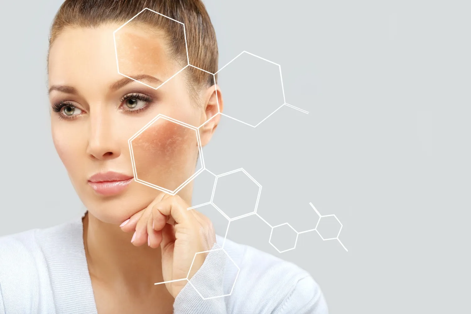 Cilt Lekeleri Nedir ve Cilt Lekelerini Nasıl Önleyebiliriz?