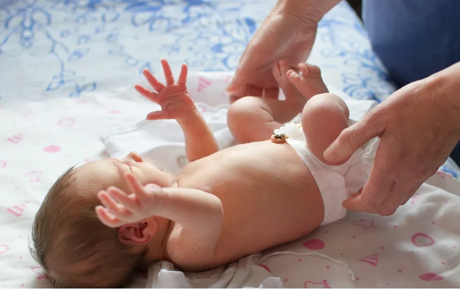 Çocuklarda Kasık ve Göbek Fıtığı Belirtileri Nelerdir? Nasıl Tedavi Edilir?