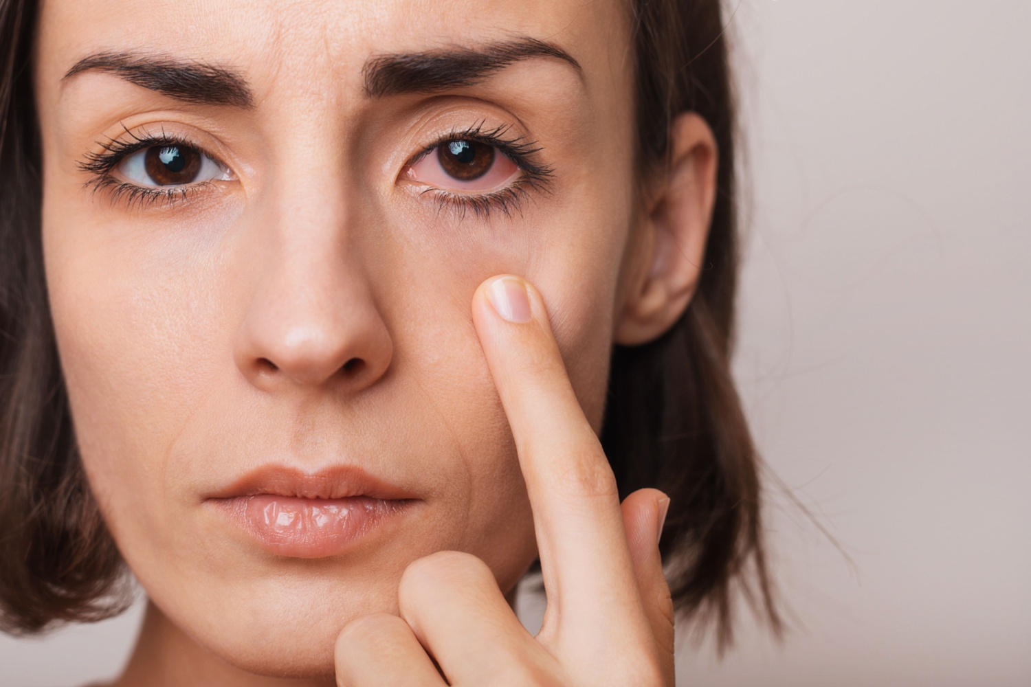 Göz Seyirmesi Nedir? Nasıl Geçer?