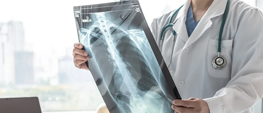 KOAH Patofizyoloji Nedir?