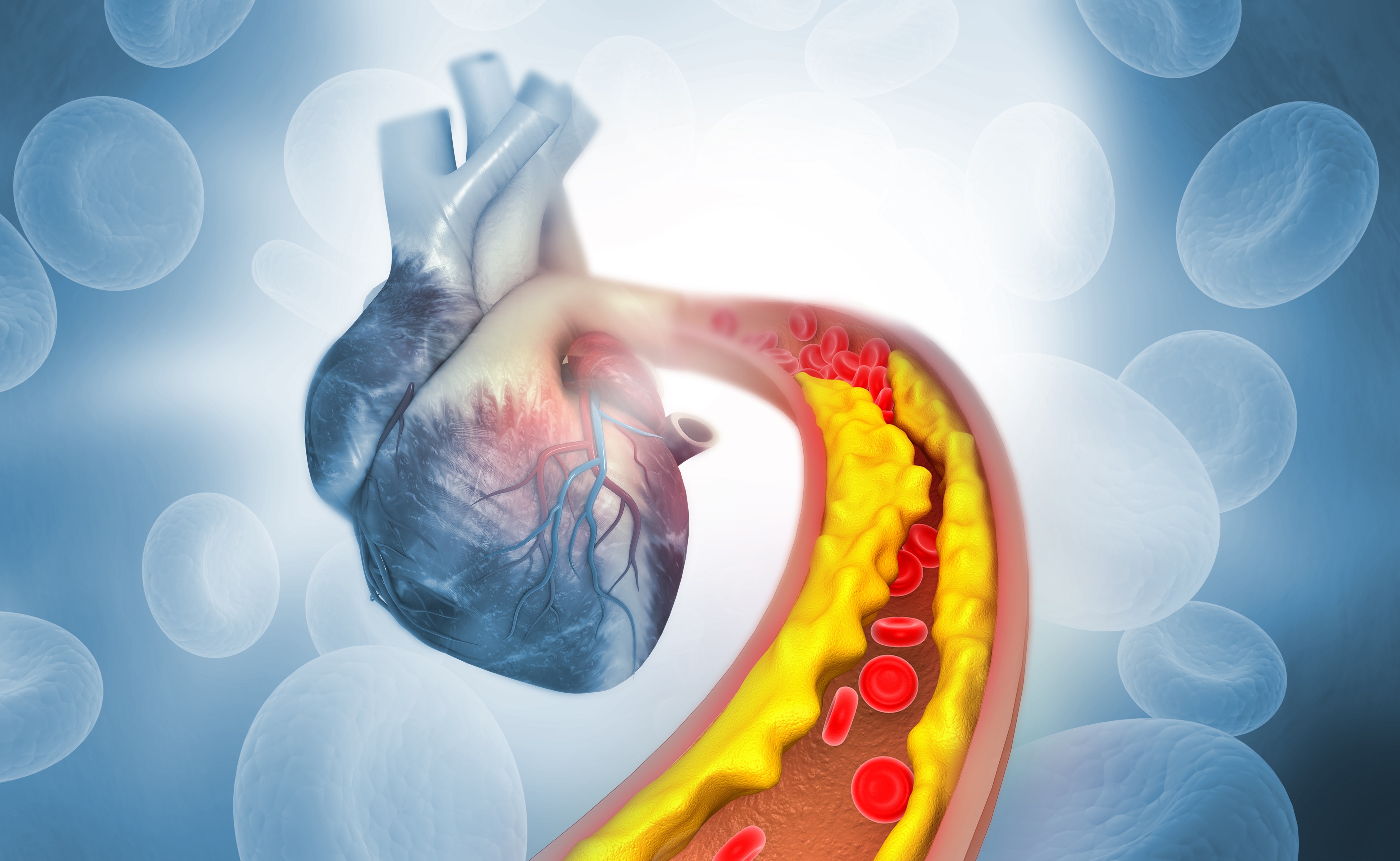 Kolesterol Yüksekliği (Hiperlipidemi) Nedir? Kolesterol Yüksekliği Belirtileri Nelerdir?