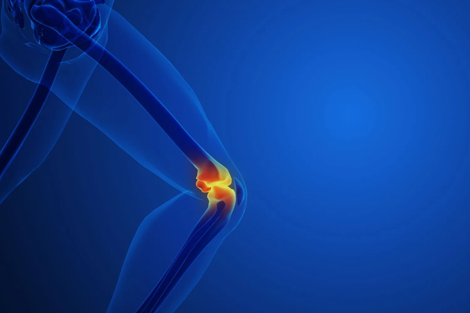 Menisküs Yırtığı Nedir? Belirtileri ve Tedavi Seçenekleri Nelerdir?