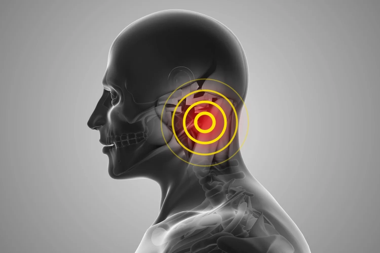 Miringoplasti Ameliyatı Nedir? Hangi Durumlarda Yapılır?