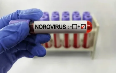 Norovirüs Nedir ve Belirtileri Nelerdir?