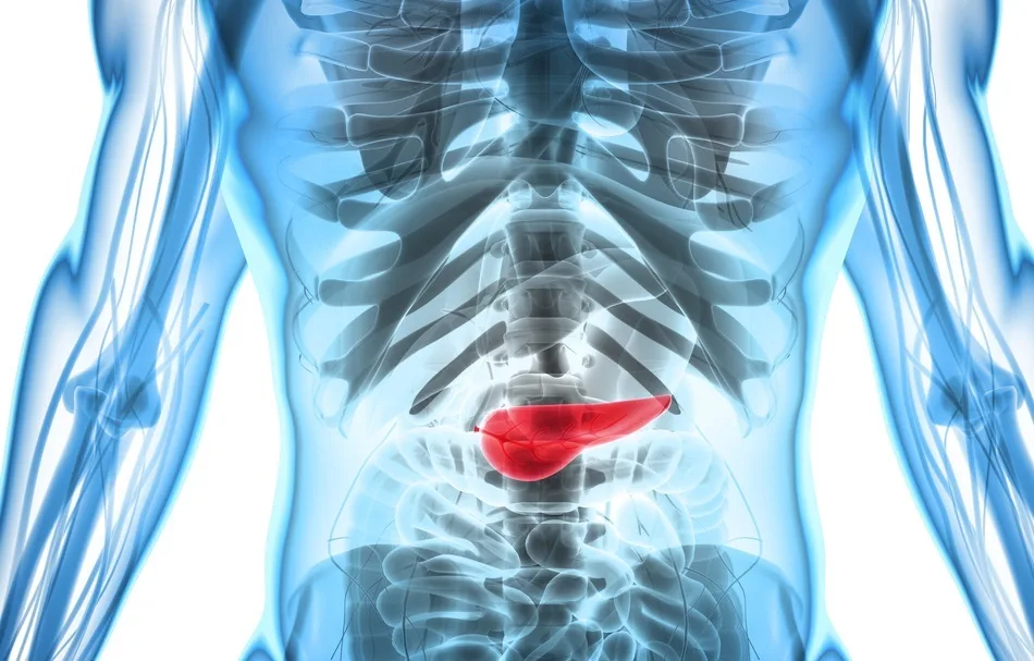 Pankreas Ameliyatı Ne Zaman Zorunlu Hale Gelir? Ameliyat Kararı Nasıl Verilir?