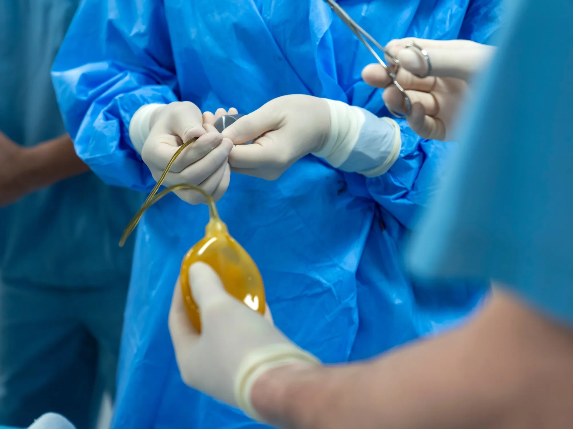 Penil Protez Nedir ve Nasıl Çalışır?