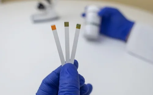 Vajinal Sağlık Doğal pH Dengesini Koruma Rehberi