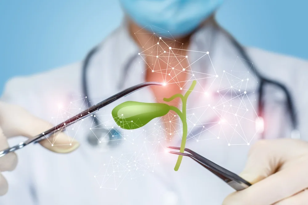 Safra Kesesi Taşı Belirtileri Nelerdir? Safra Kesesi Ameliyatı Riskli Mi?