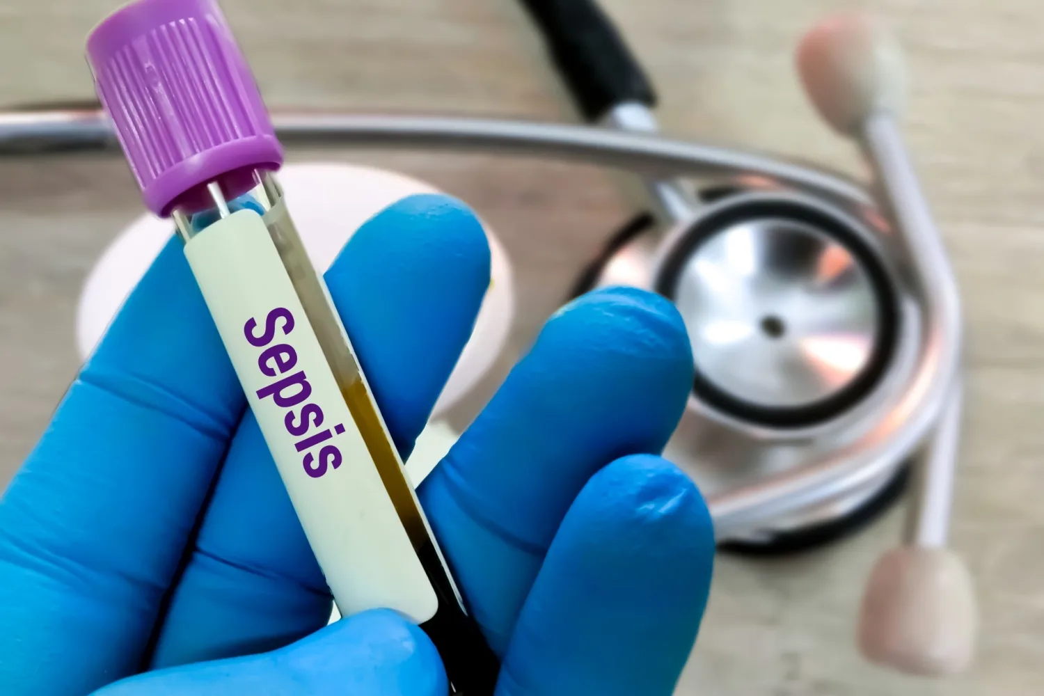 Sepsis Nedir? Belirtileri ve Tedavi Yöntemleri Nelerdir?