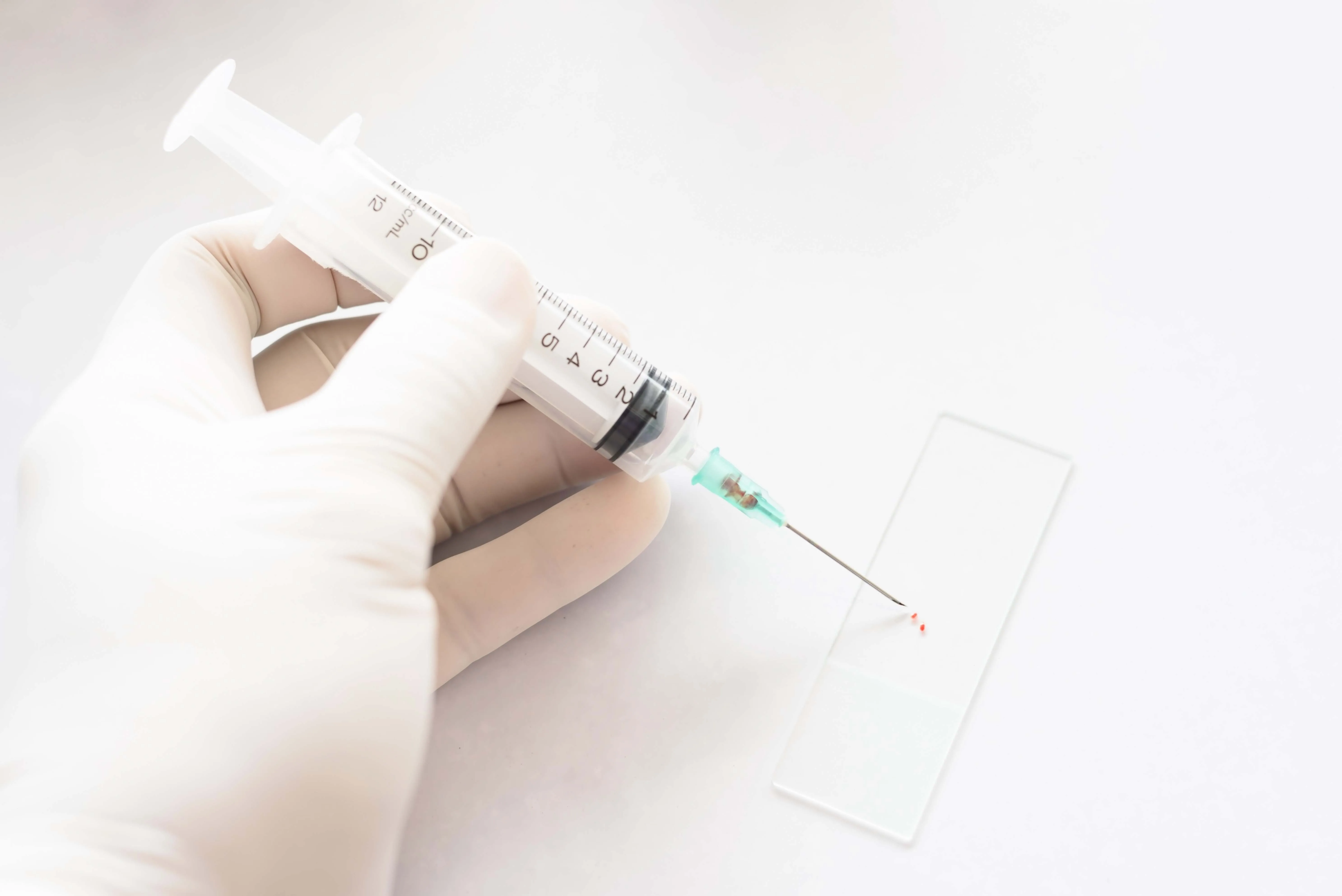 Tiroid İnce İğne Aspirasyon Biyopsisi Nedir? Nasıl Uygulanır?