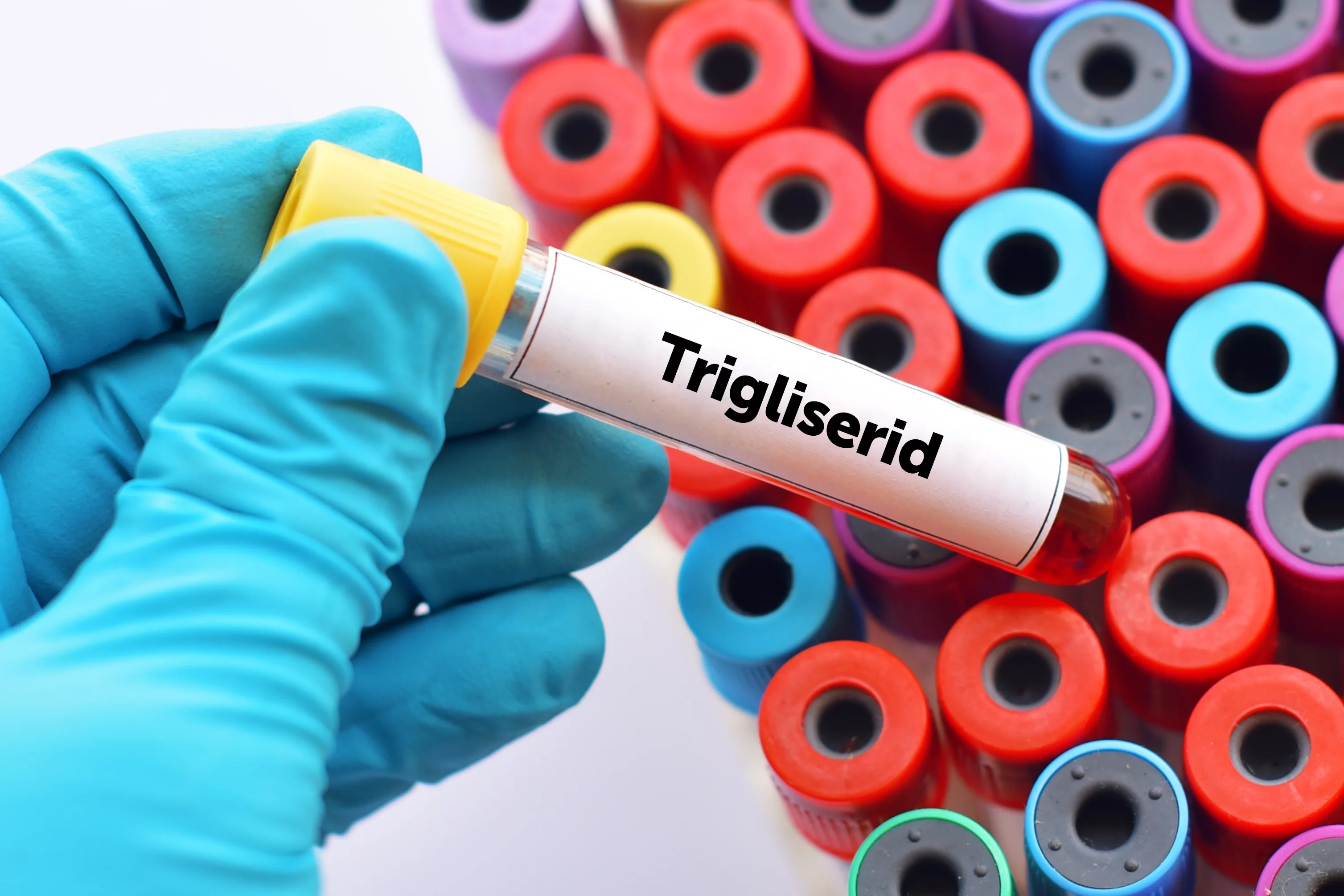 Trigliserid Nedir? Trigliserid Yüksekliği Nedir?