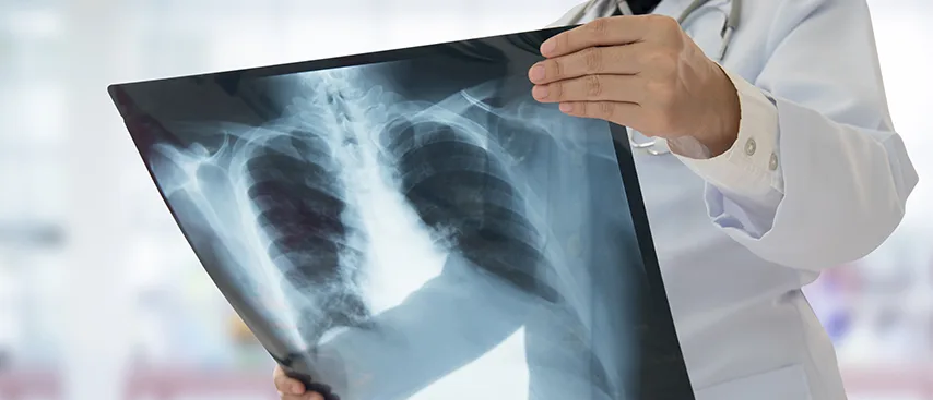 Riskli Gruplara Zatürre Aşısı Yapılması Hayati Önem Taşıyor